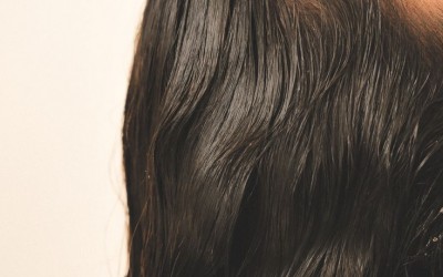 Псоріаз на голові: як виглядає, чим відрізняється від себореї і який догляд не нашкодить